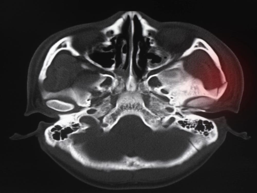 Chicago lawyer helping victims of bike accidents with face injuries.