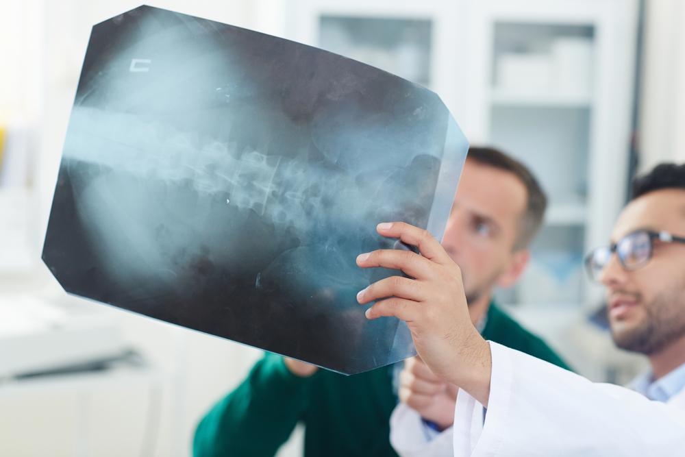 Chicago bike accident lawyer handling bicycle accident paralysis cases, ensuring victims receive the compensation they deserve through a paralysis lawsuit.